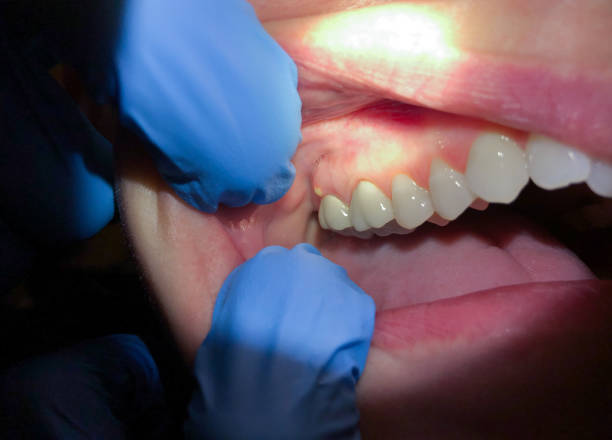 Best Emergency Dentist for Knocked-Out Tooth in Basehor, KS