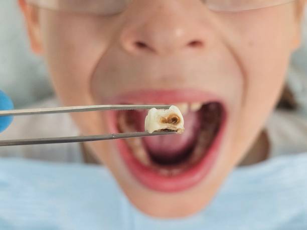 Best Orthodontic Emergency Dentist in Basehor, KS