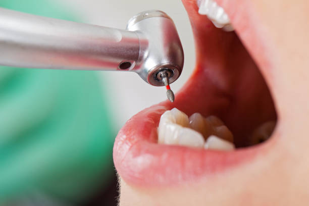 Best Pediatric Emergency Dentist in Basehor, KS